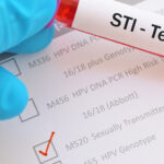 Young slim woman enjoys weight loss result