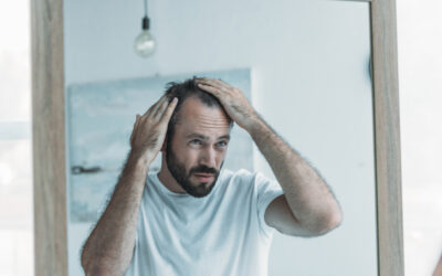 Unlocking the Genetic Puzzle of Baldness: Insights from OMNIA TeleHEALTH