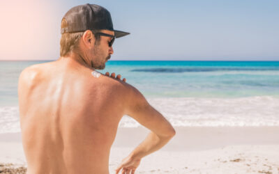 The Critical Role of Sun Protection in Preventing Premature Skin Aging