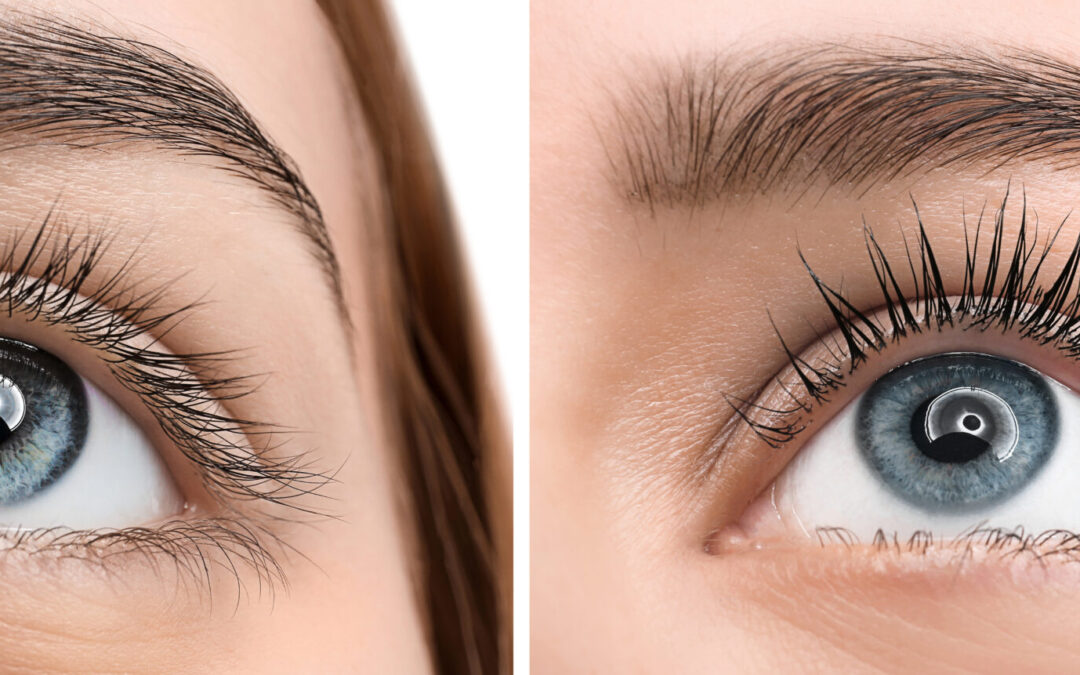 Which Botanical Remedies Enhance Eyelash Growth?