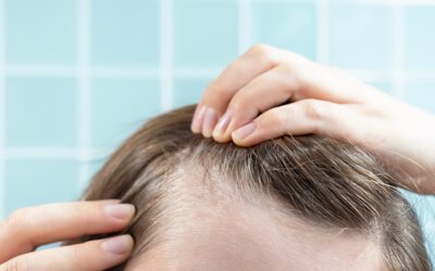 Hormones and Hair Loss: How to Identify and Treat Hormonal Imbalances