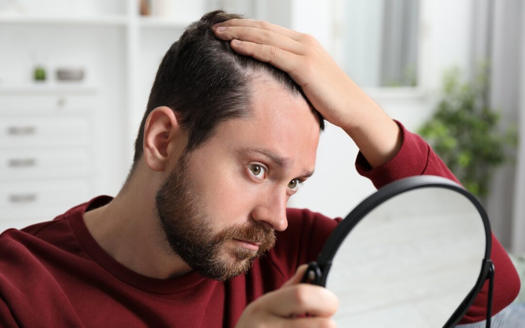 An In-Depth Look at Hair Loss Solutions: From Over-the-Counter Treatments to Professional Care