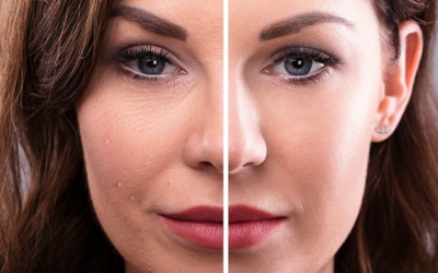 Combat Wrinkles with Everyday Wellness and Preventive Care: Expert Tips from Omnia Telehealth